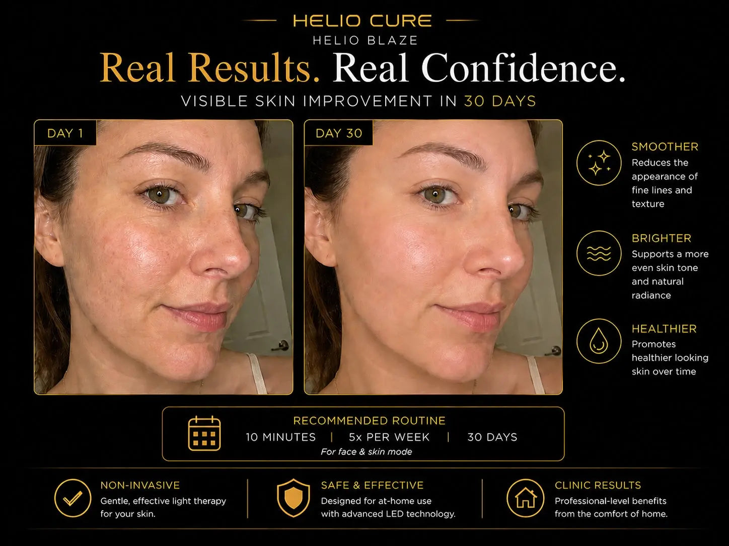 Helio Blaze red light therapy before and after results showing smoother, healthier-looking skin.