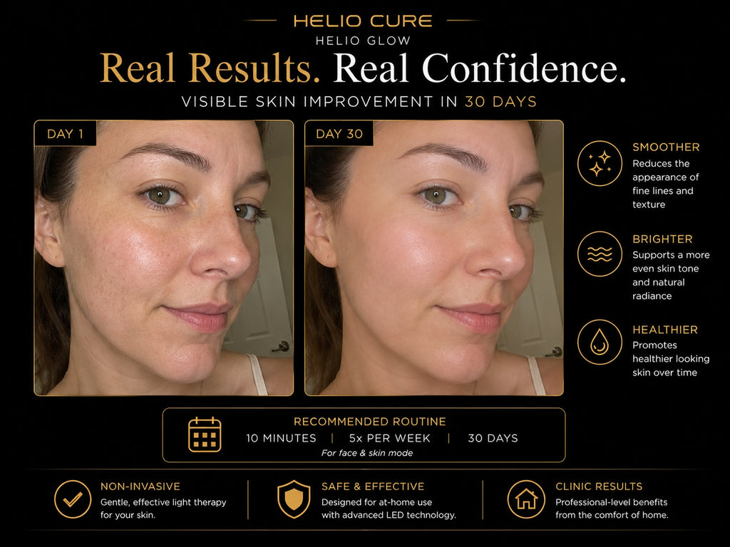 Helio Cure Helio Glow red light therapy before and after results showing smoother, brighter, and healthier-looking skin after 30 days of treatment.