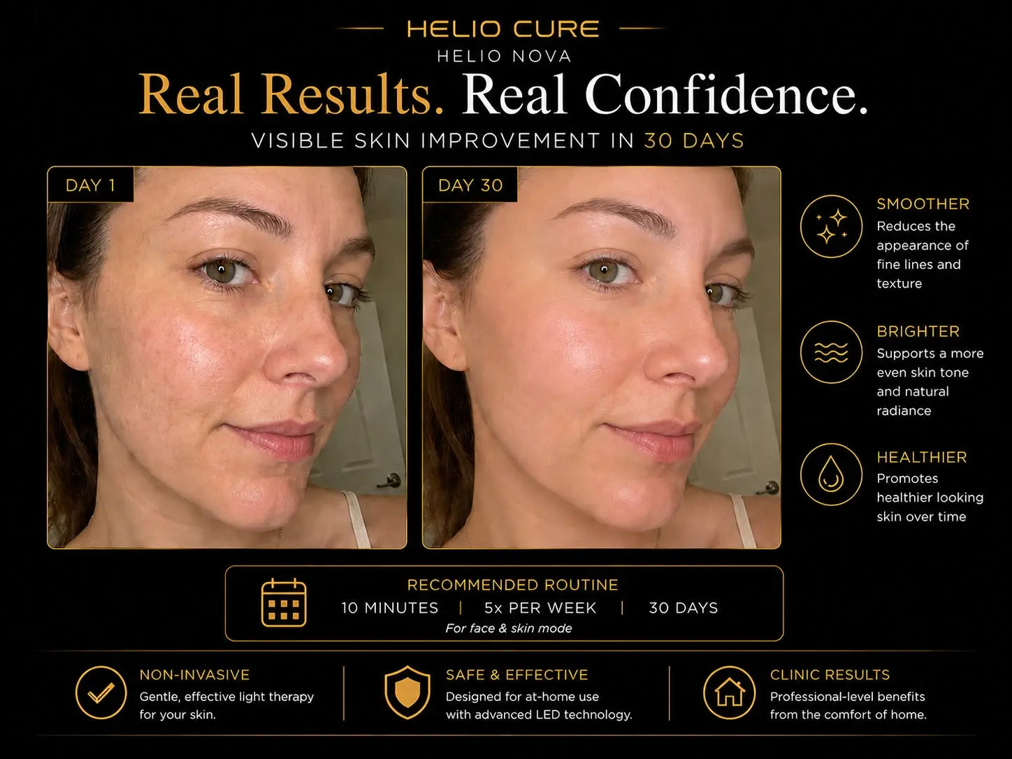 Helio Nova red light therapy before and after results showing visible skin improvement over 30 days.